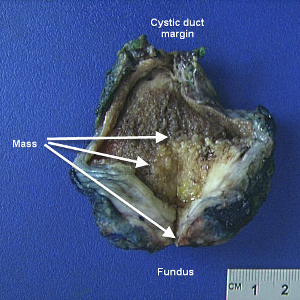 Macroscopic image of a organ biopsy